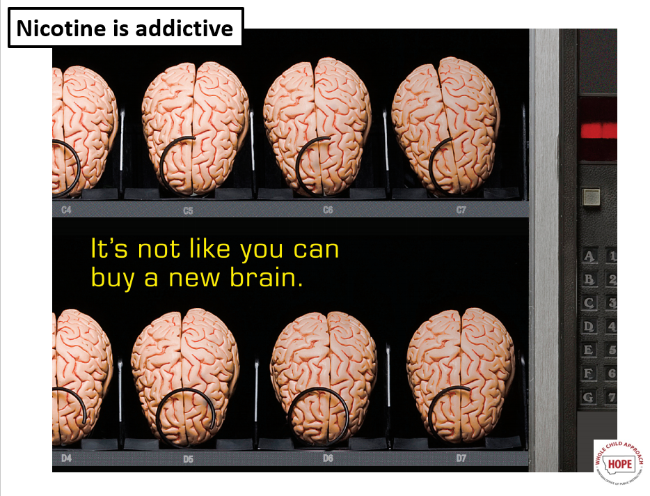 You can't buy a new brain