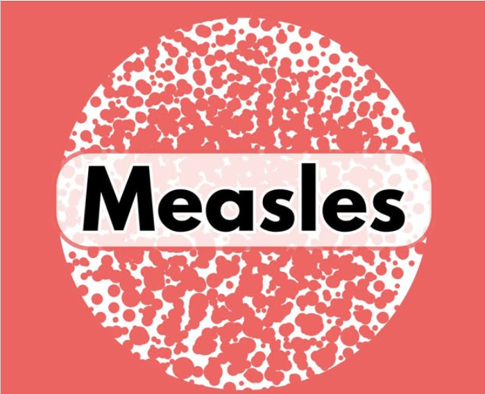 measles