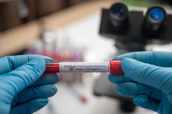 Photo of positive Covid-19 blood test