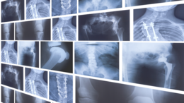 Thumbnail image of X-ray scans