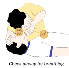 rescue breathing illustration