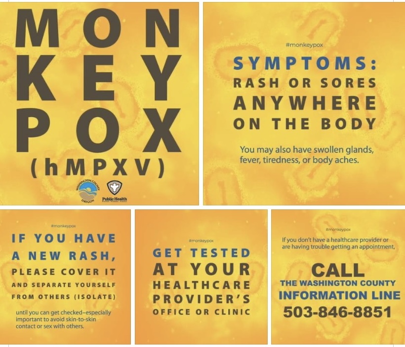 Monkeypox information 