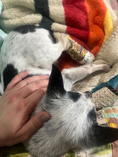 Harvey Milk Broken Leg