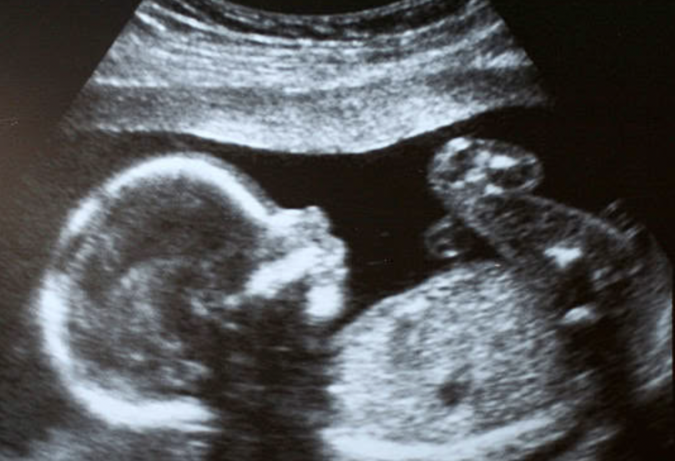 ivf