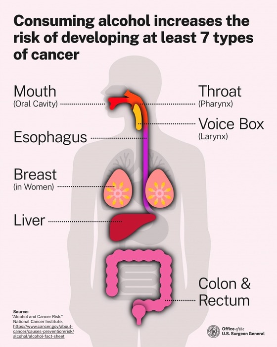 Alcohol and Cancer Risk Image