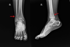 foot xray podiatrist