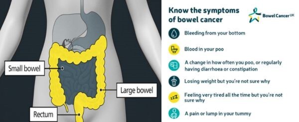 Bowel Cancer Awareness