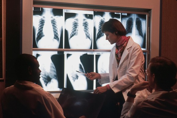 A female doctor inspects a series of x ray images