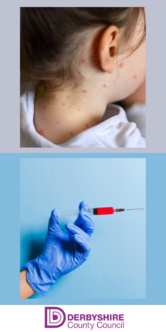 Measles Graphic - Case and Needle Injection