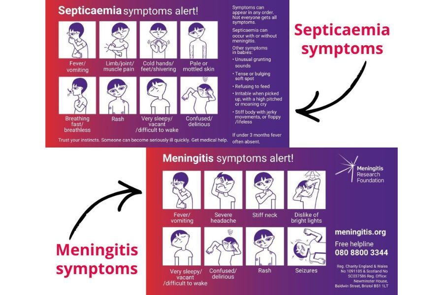 Graphic shows the signs and symptoms, described in the news story, for meningitis and septacaemia