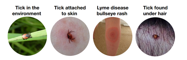 Images of a tick in the environment, a tick attached to skin, a Lyme disease bullseye rash and a Tick found under hair