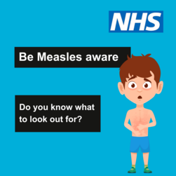 Be measles aware, do you know the symptoms?