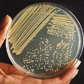 Petri dish with bacteria colonies growing on it