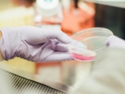 Cell culture in a petri dish