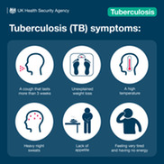 TB signs and symptoms