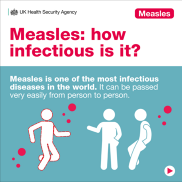measles how infections is it asset