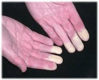 Fingers