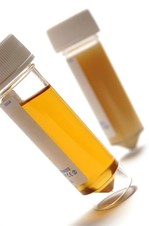 Urine samples