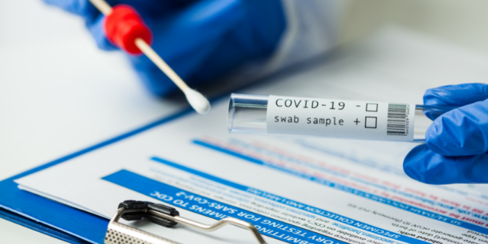 COVID-19 PCR testing