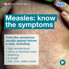 Measles know the symptoms