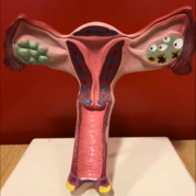 uterus model
