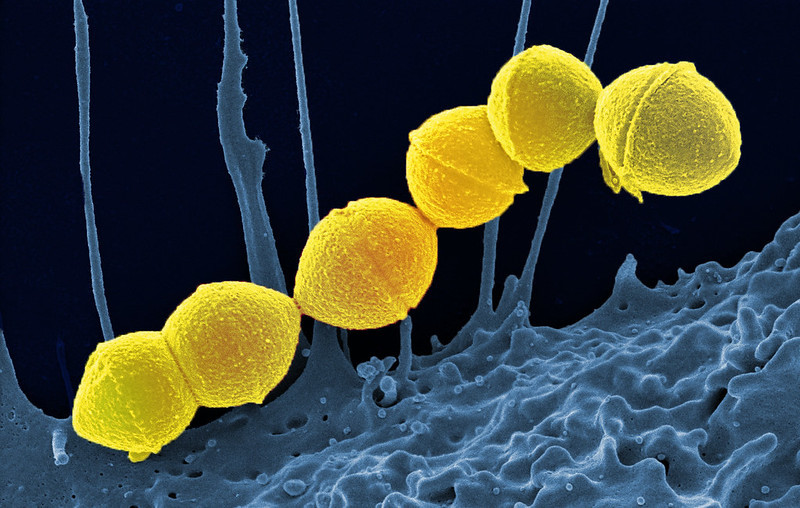 Photo of Group A Strep bacteria
