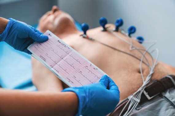 Gloved hands holding ECG readings in front of patient/ subject