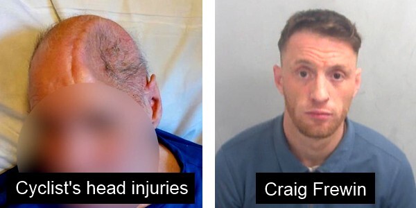Cyclist's head injuries and custody picture of lorry driver Craig Frewin