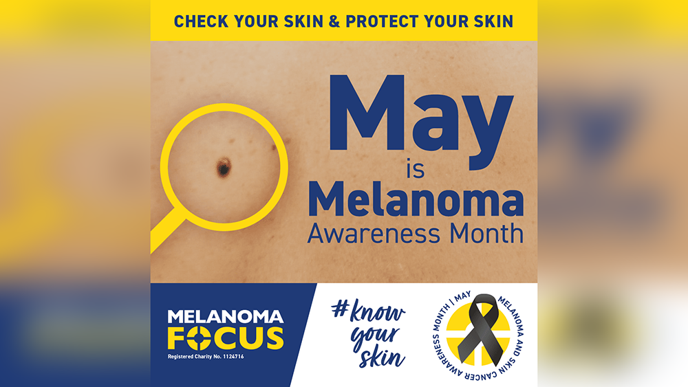 Social graphic featuring a dark mole on a person's back, captioned: 'May is Melanoma Awareness Month'.