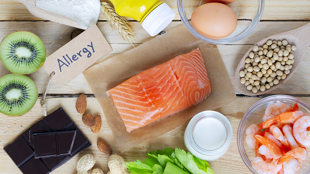 Common allergenic foods including kiwi, chocolate, nuts, shrimp, milk, salmon, eggs, soybeans, celery, and mustard on a wooden surface.