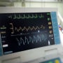 Cardiac care improving in Wales 