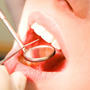 Health Secretary welcomes reduction in child tooth decay 