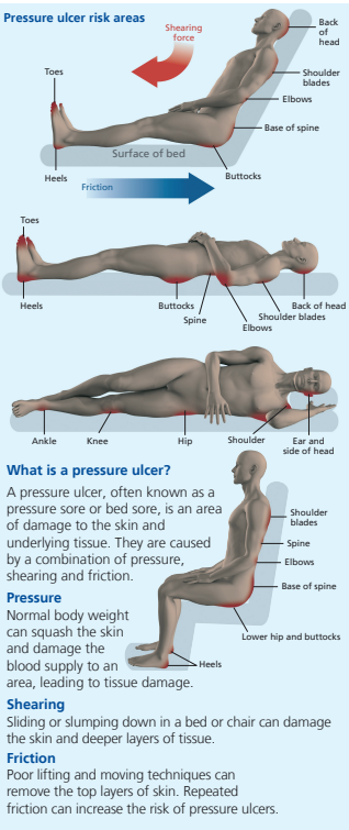 pressure care