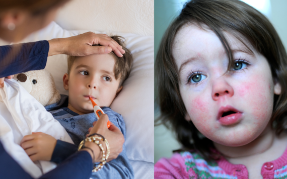 Photo of two children poorly