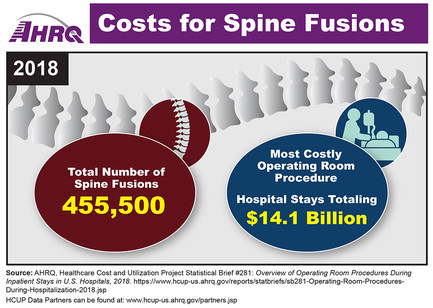 spine fusions