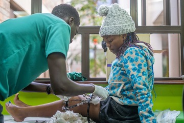 CURE KENYA MEDICAL STAFF INSTALLING THE EXTERNAL FIXATOR RECEIVED THROUGH LEPP TO JOY’S LEG. 