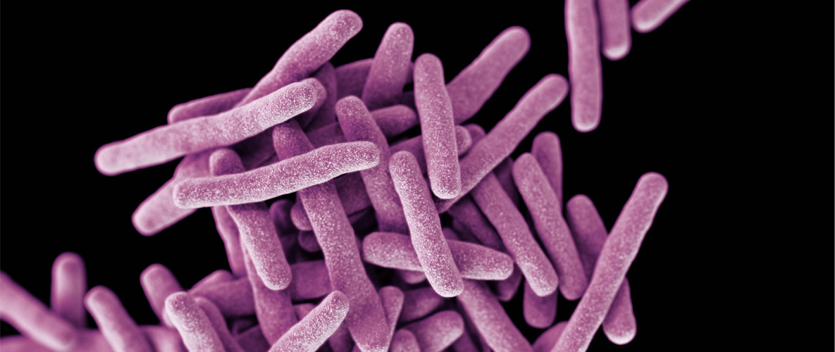 CGH - Newsletter - Jan. 8, 2016: The Threat of Drug-Resistant TB