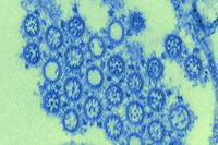 image of H1N1 virus