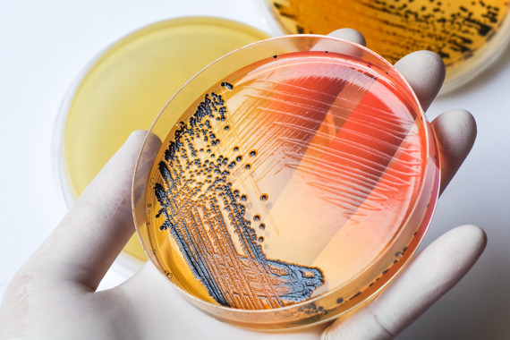 Scientist's hand in medical latex glove holding the bacteria colonies growing petri dish over bacteria plates background.