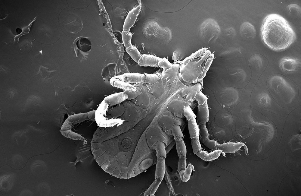 American dog tick nymph (Dermacentor variabilis)