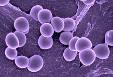 Staphylococcus aureus is a versatile bacterium found on the skin or noses of people and animals. Photo courtesy of University of Nebraska. 