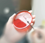 Antimicrobial resistance image courtesy of Getty Images.
