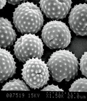 Scanning electron microscopy image of ragweed pollen, courtesy of Lewis Ziska.