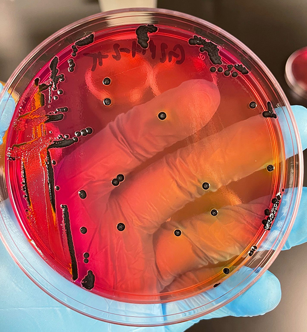 Salmonella colonies growing on red indicator plates, image courtesy of the University of Georgia.