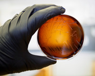 Food safety pathogen Listeria monocytogenes isolated on agar from a food sample. Courtesy of Adobe Stock.