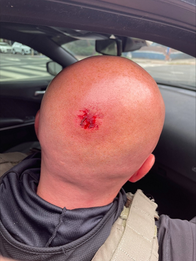 One of our law enforcement officers being thrown on the ground and receiving a concussion on August 16.