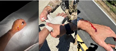 Representative Salud Carbajal was among the mob of rioters who attacked federal immigration authorities.