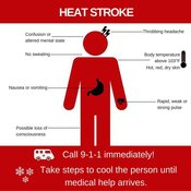 Heat stroke infographic