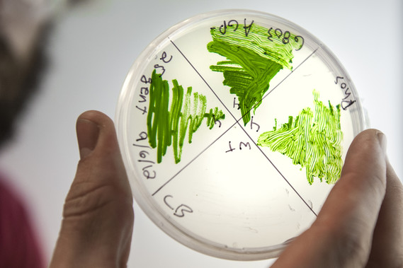 Cyanobacteria in petri dish