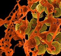 methicillin-resistant Staphylococcus aureus (image: NIAID)